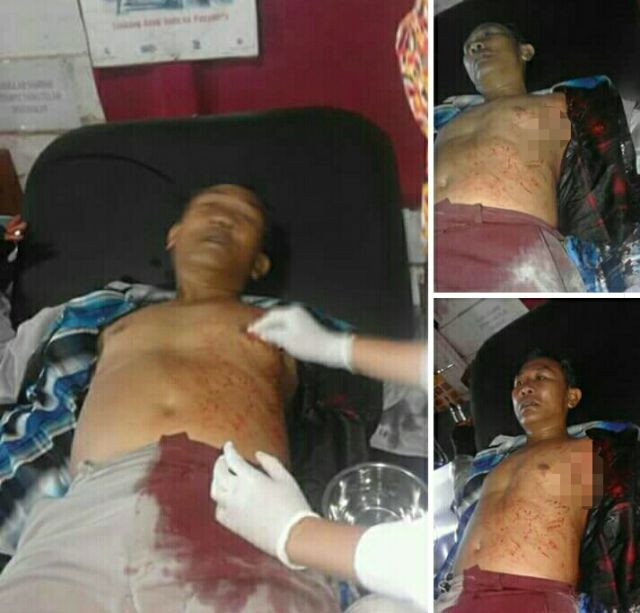 Dibegal 6 Orang, Tukang Kasur Nyaris Tewas